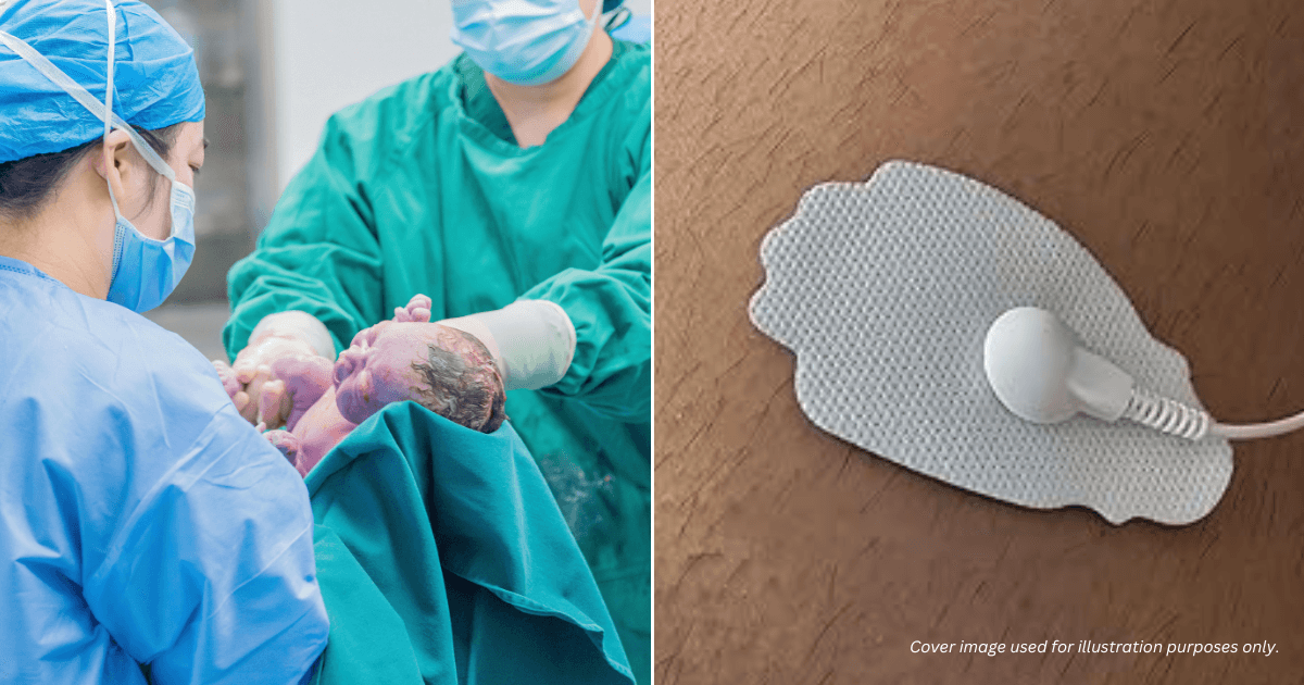 A description of the image