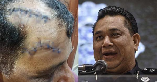 A description of the image