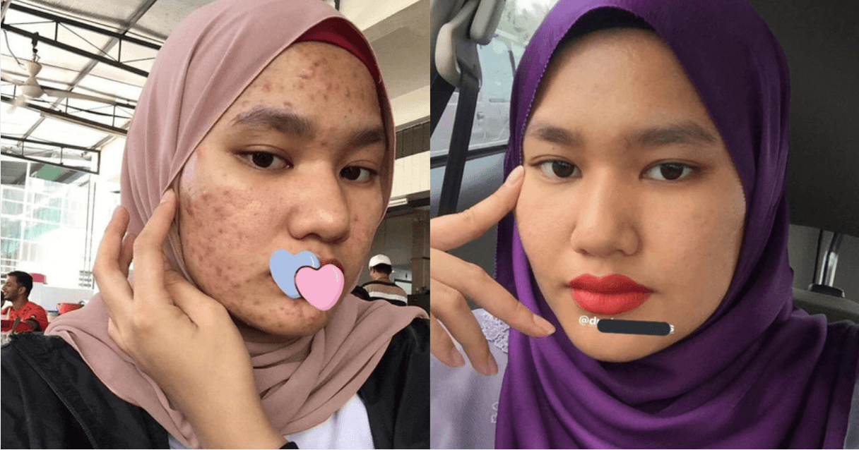 A description of the image