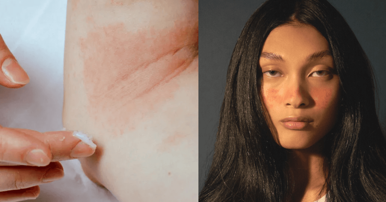 A description of the image