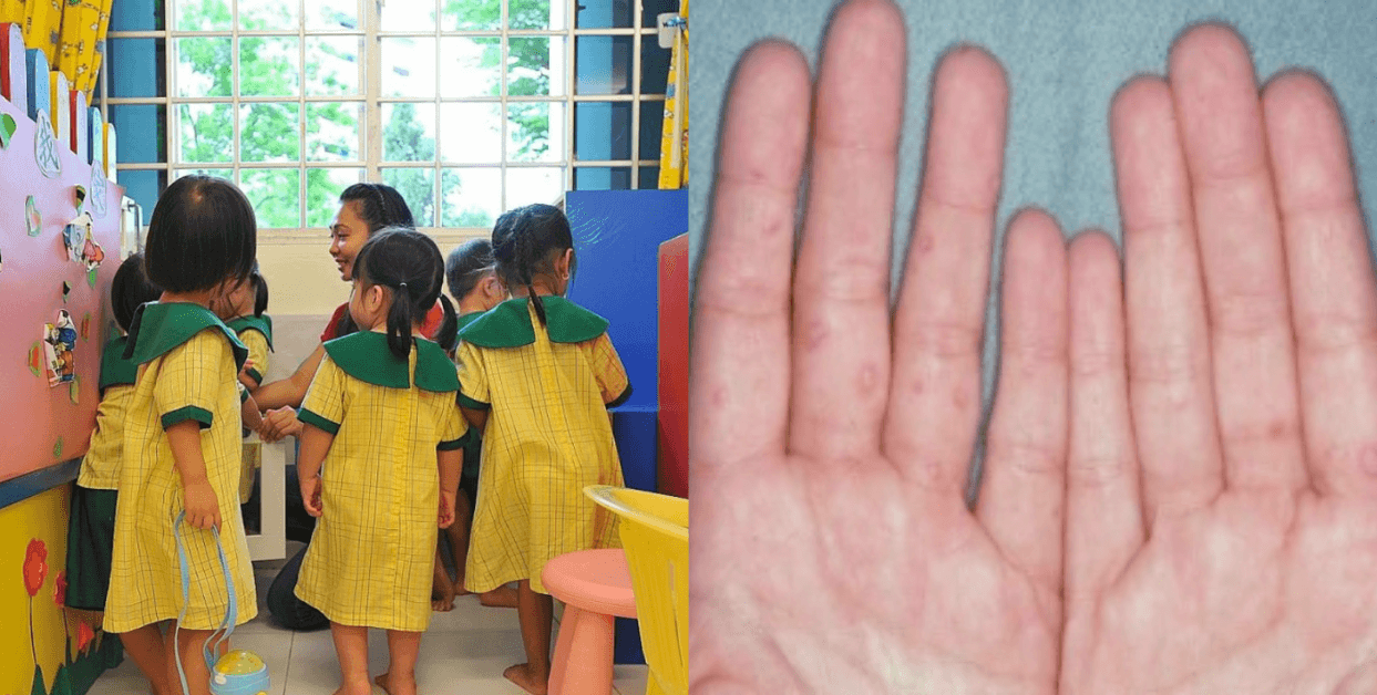 A description of the image