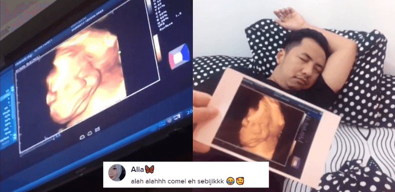 A description of the image