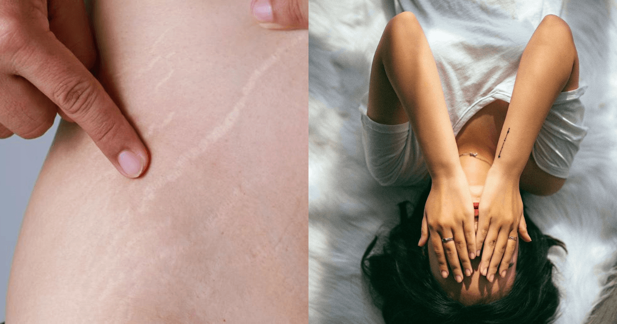 A description of the image