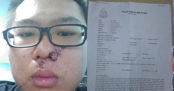 A description of the image