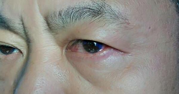 A description of the image