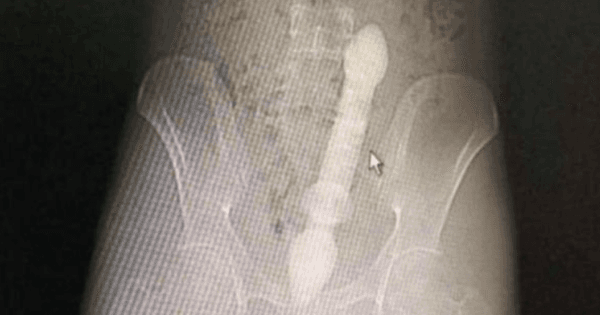 A description of the image