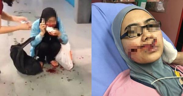 A description of the image