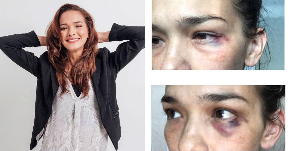 A description of the image