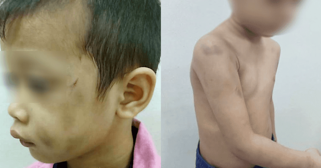 A description of the image