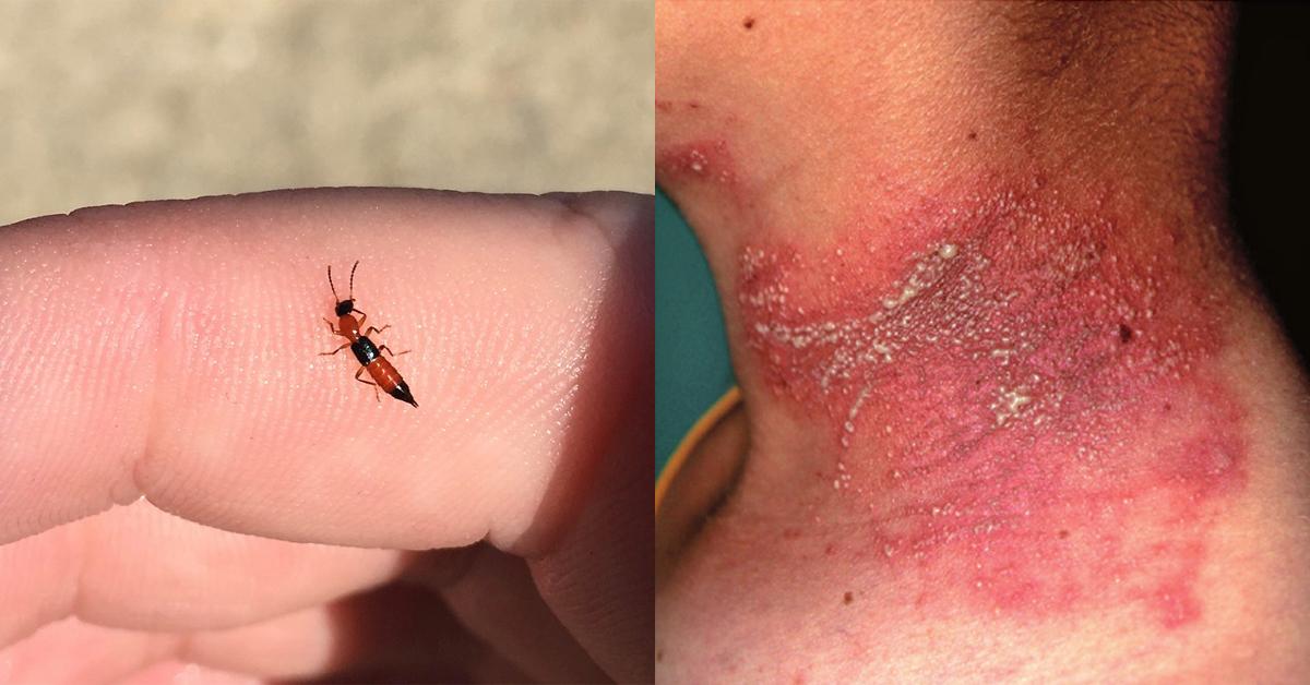 A description of the image