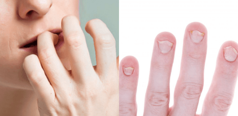 A description of the image