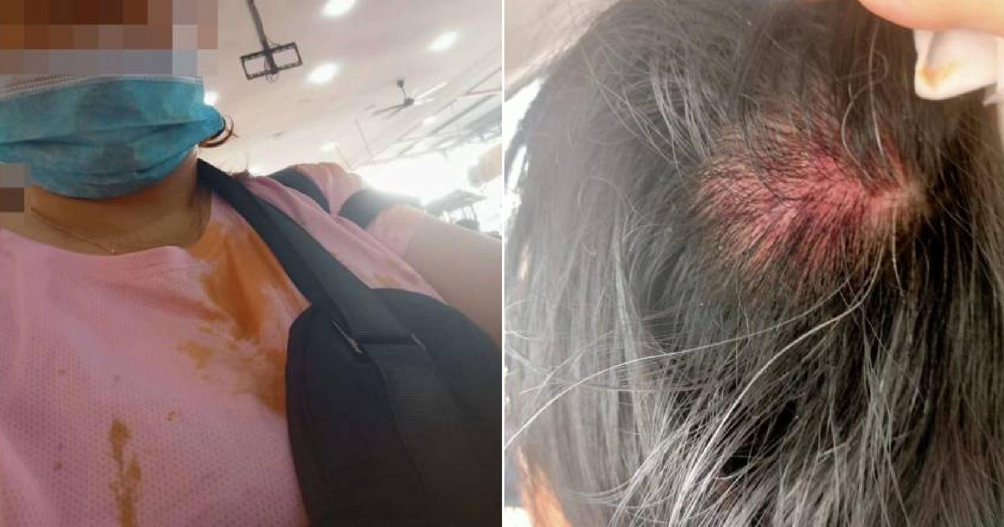 A description of the image