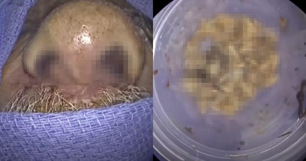 A description of the image