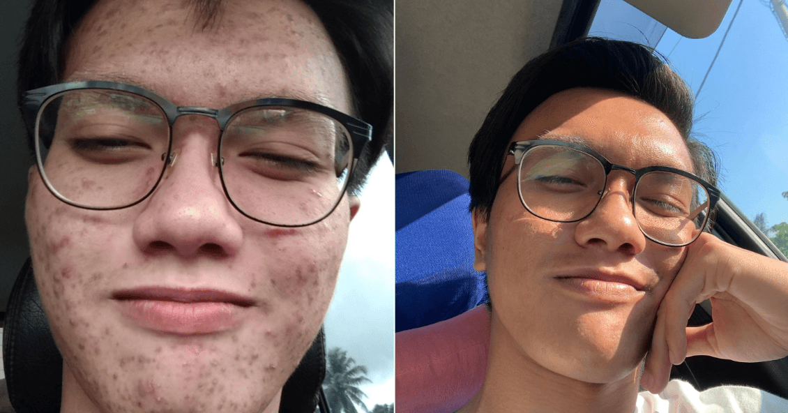 A description of the image