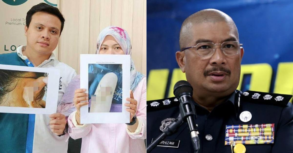 A description of the image