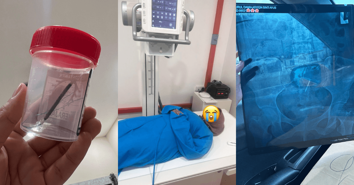 A description of the image